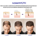 Estimule a Renovação da Pele: Derma Roller System 0.50mm 1.0mm 1.5mm 2.0mm