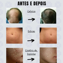 Estimule a Renovação da Pele: Derma Roller System 0.50mm 1.0mm 1.5mm 2.0mm