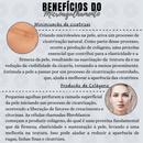 Estimule a Renovação da Pele: Derma Roller System 0.50mm 1.0mm 1.5mm 2.0mm