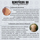 Estimule a Renovação da Pele: Derma Roller System 0.50mm 1.0mm 1.5mm 2.0mm